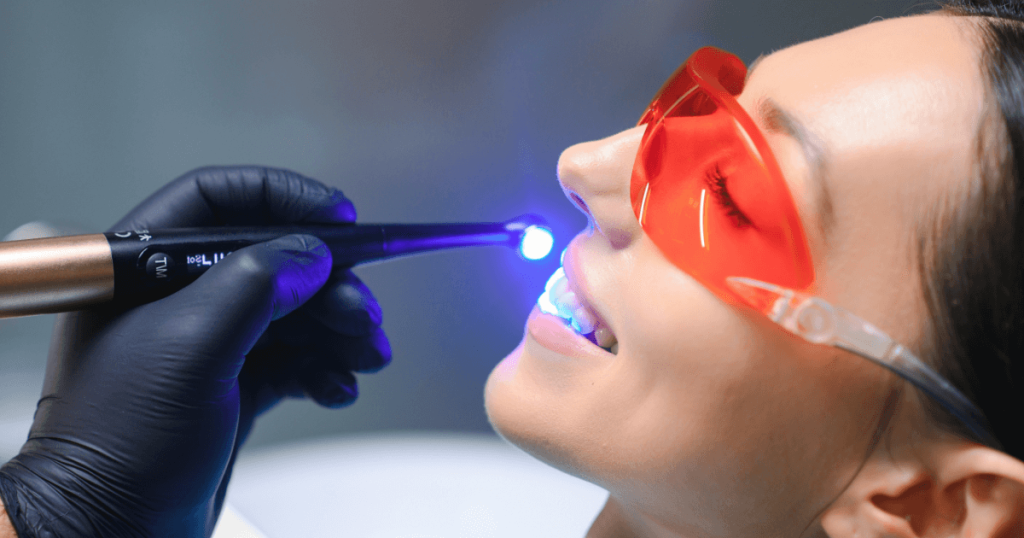 lasersko izbjeljivanje zuba